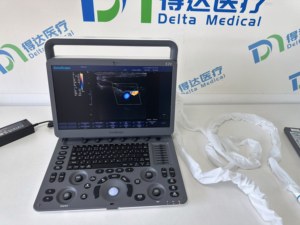 Ecógrafo Veterinario Sonoscape E2/E10/E11 Doppler Color para Perros, Gatos y Caballos con Sonda Rectal y Convexa - Product Image 2