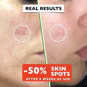 Suero de Vitamina C y Ácido Hialurónico de Marca Privada, Iluminador e Hidratante para Piel Seca y Sensible - Product Image 5