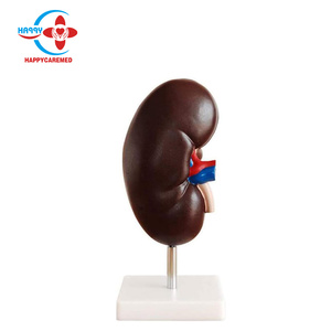Modèle pédagogique de l'anatomie du rein humain HC-S266, structure rénale - Product Image 5