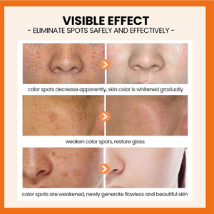 Private Label Glutathion Vitamin C Arbutin Niacianmide Hautpflege Aufhellende Gesicht Körper aufhellung Serum Hautpflege Set Produkte - Product Image 5
