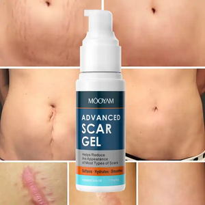 Gel Avanzado para Cicatrices MOOYAM 50ml, Crema Efectiva para Eliminar Cicatrices de Cesárea y Estrías - Product Image 1