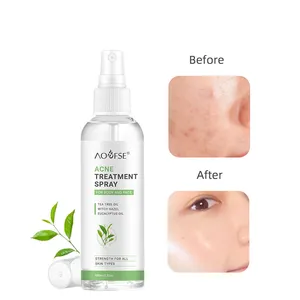 Acne Treatment Water Tea Tree Acne Prone Skin Clear Toner with Shrink Pore Acne Toner