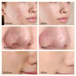 Mascarilla Facial de Arcilla de Cúrcuma Vegana Natural, Fórmula de Vitamina E y Aloe Vera de Marca Blanca, Purifica la Piel, Reduce los Puntos Negros, el Acné y Minimiza los Poros - Product Image 5