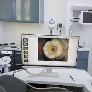 Endoscopio dentale elettrico All-in-One con chiara impugnatura dello schermo di Imaging in tempo reale per una diagnosi efficiente - Product Image 5