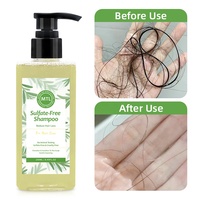 Shampooing au Romarin Sans Sulfate pour la Croissance Capillaire, Bloqueur Naturel de DHT pour Réduire la Chute de Cheveux, Renforcer les Follicules et Augmenter le Volume