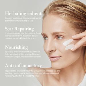 Crema Herbal para Eliminar Cicatrices y Reparar la Piel, Antiinflamatoria, para el Cuidado Diario, 100g, para Todo Tipo de Piel, Venta al Por Mayor - Product Image 4