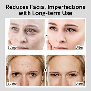 Sérum pour le visage à l'acide hyaluronique et à l'alpha-arbutine, anti-âge, anti-rides, hydratant, pour les marques d'acné et les taches brunes, OEM ODM - Product Image 6