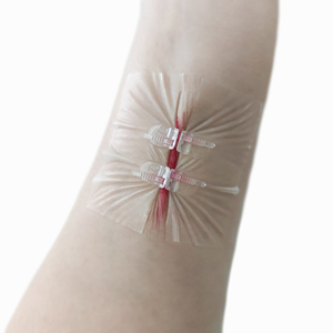 Tira de cierre de piel quirúrgica de alta calidad para heridas de puñaladas o heridas cortadas - Product Image 2