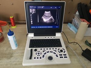 Machine à ultrasons JM-806H Chine Meilleur fabricant Portatil Ultrason pour ordinateur portable - Product Image 5