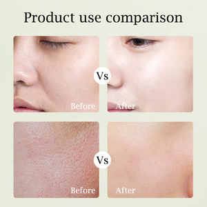 Gel Smoothie aux acides aminés de marque privée <span class=keywords><strong>lait</strong></span> nettoyant pour peau grasse nettoyage en profondeur éliminer la saleté de l'huile résidus de maquillage effet raffermissant - Product Image 6