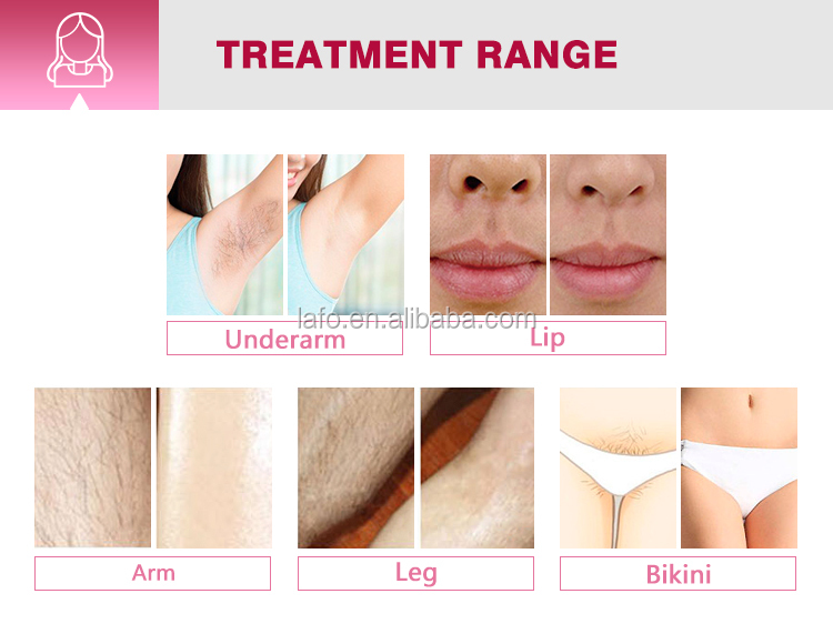 NEW High power Permanent 808nm laser diode hair removal laser 808nm diode hair remover machine