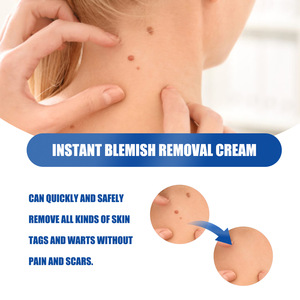 Suero para eliminar <span class=keywords><strong>verrugas</strong></span> de la piel, <span class=keywords><strong>crema</strong></span> reparadora de la piel, removedor de <span class=keywords><strong>verrugas</strong></span>, removedor de <span class=keywords><strong>verrugas</strong></span> <span class=keywords><strong>genitales</strong></span> para hombres - Product Image 4