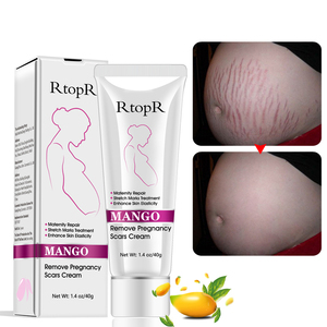 Crème à la Mangue pour Vergetures de Grossesse, Répare les Cicatrices et les Vergetures Abdominales - Product Image 2