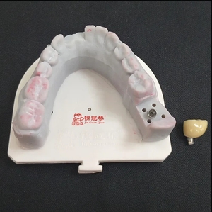 ส่วนบนของฟันเทียมไทเทเนียมพิมพ์ดิจิตอล3D แบบกำหนดเองเหมาะสำหรับระบบฝังหลัก - Product Image 2