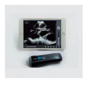 <strong>Ultrasound</strong> Probes Wireless Portable <strong>Hand</strong> <strong>Held</strong> Mini Wifi Doppler Probe <strong>Ultrasound</strong> Scanner - Product Image 6