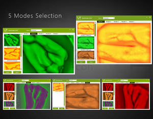 MC409 Pencari Vena Inframerah Portabel Paling Hemat Biaya dengan Lensa IR 1080P untuk Menunjukkan Gambar Pembuluh Darah Di Komputer - Product Image 4