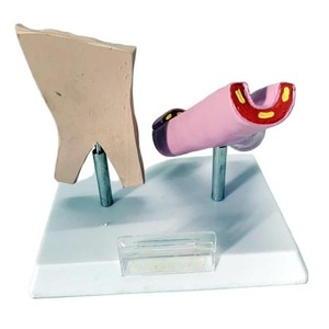 Modelo de Comparación de Vasos Sanguíneos Normales <span class=keywords><strong>y</strong></span> Vasos Dañados por el Tabaco, Estructura Vascular, Enseñanza Anatómica, <span class=keywords><strong>Ciencia</strong></span> Popular - Product Image 2