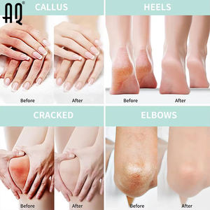 Meilleur <span class=keywords><strong>20</strong></span>% <span class=keywords><strong>urée</strong></span> arbre à thé et <span class=keywords><strong>crème</strong></span> d'aloe vera pour les soins de la peau des pieds L'acide hyaluronique hydratant en profondeur apaise et adoucit la peau sèche - Product Image 5