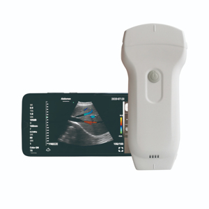 Escáner de Ultrasonido Inalámbrico Portátil de Doble Cabezal, Mini, de Alta Calidad y Bajo Costo, para Uso Veterinario y Humano, Dispositivo de Diagnóstico - Product Image 1