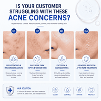 Soins de la peau coréens, crème réparatrice contre l'acné en 7 jours, traitement anti-boutons, crème correctrice des taches brunes, crème pour le visage non comédogène, peau sensible