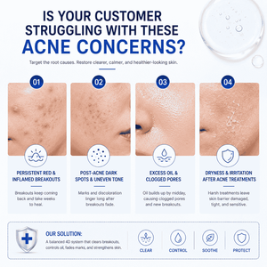 Crema Reparadora para el Acné 7 Días de Korea Skincare, Tratamiento Anti-Espinillas, <span class=keywords><strong>Corrector</strong></span> de Manchas Oscuras, Crema Facial <span class=keywords><strong>No</strong></span> Comedogénica para Piel Sensible - Product Image 3