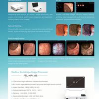 Système d'endoscopie HD portable Endoscope ORL Prix de gros Caméra d'endoscope médical pour la gorge du nez de l'oreille