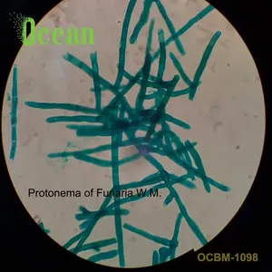 Protonema من Funaria w.m مجهر بيولوجي طبي تم تصميمه شريحة