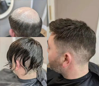 Cheveux humains 100% non traités 1B #   Système de remplacement capillaire naturel : Base de perruque à souder, toupée droite pour hommes