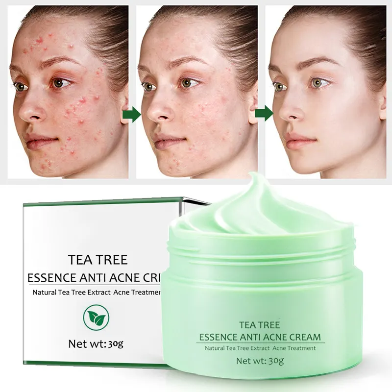 Etiqueta privada profesional té verde cuidado de la piel acné eliminar Corea loción facial antiacné reparación té verde árbol crema facial