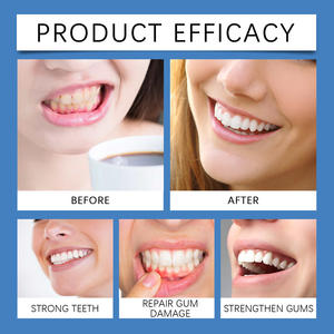 En Oferta, Enjuague Bucal K0123 de 120 ml con Sabor a Menta, Sin Alcohol, para el Cuidado Bucal, Blanqueamiento Dental, Sabor Refrescante, Vitamina E, para Uso en Casa y Viajes - Product Image 3