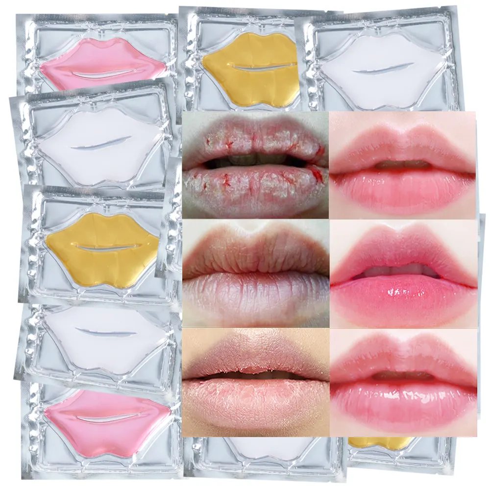 Groothandel Roze Goud Lipverzorging Hydrogel Hydraterende Lip Plumpe Hydraterende Collageen Lip Slaapmasker