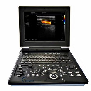 Échographe Doppler Couleur Ultra-Abordable pour Usage Médical, Vétérinaire et Humain - Scanner à Ultrasons Prix Compétitif CU20 - Product Image 1
