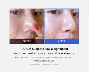 Medicube - Cuidado de la Piel Coreano con Ácido Salicílico, Líquido Exfoliante para Cero Poros, Cuidado de los Poros con AHA BHA, Blanqueador, Hialurónico - Product Image 3