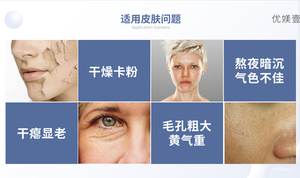 Gel de 1 ml con Ácido Hialurónico <span class=keywords><strong>Reticulado</strong></span>, Hidratante Multiusos y Antiarrugas, Ingrediente Estrella Antienvejecimiento <span class=keywords><strong>para</strong></span> Rostro, <span class=keywords><strong>Labios</strong></span>, Ojos y Nariz - Product Image 3