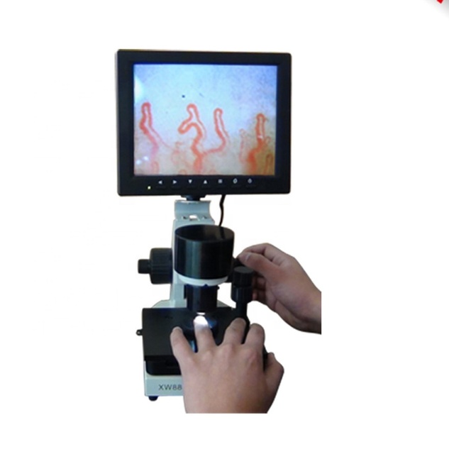 BIOBASE  Blood Capillary Microcirculation Microscope