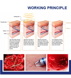 Láser de Diodo 2027 35w 980nm +9w 1470nm para Lipólisis, Cirugía Plástica Corporal, Pérdida de Peso, Inyección de Fibra, Lifting Facial, Cepillo de Limpieza Facial - Product Image 2