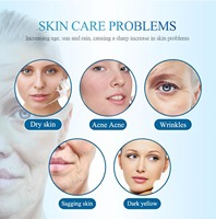 Máquina de Hidrodermoabrasión Facial Multifuncional de Alta Calidad con Agua, Oxígeno e Hidrógeno