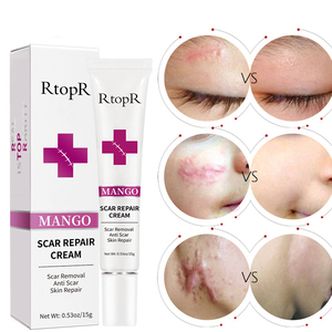 Haute qualité RtopR nourrissant en profondeur apaisant blanchissant hydratant gel de traitement réduisant l'acné brûlure <span class=keywords><strong>grossesse</strong></span> cicatrice crème de réparation - Product Image 1