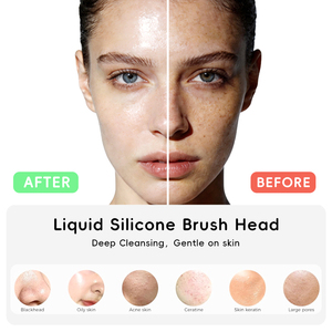 Cepillo Facial de Silicona con Vibración Sónica y Luz Roja, Herramienta de Belleza Portátil e Impermeable para la Limpieza Facial Diaria - Product Image 3