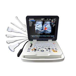 Meilleur prix - Échographe Doppler couleur portable de 15 pouces - Échographe professionnel - Échographe vétérinaire - Product Image 6