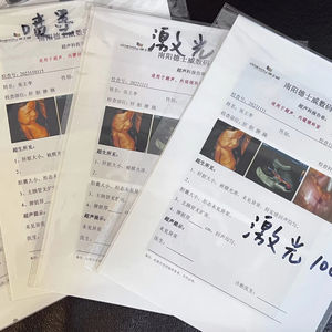 Hastaneler/Klinikler ve PET Kullanımı için Sıcak Satış A3/A4/A5 Beyaz Lazer Tıbbi Röntgen Filmi - Product Image 1