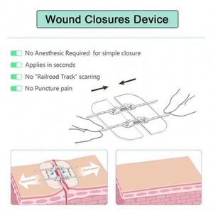 Best Price 180G/M2 Fabric Weight Non-Woven Medical Adhesive <b>Tape</b> - Product Image 2