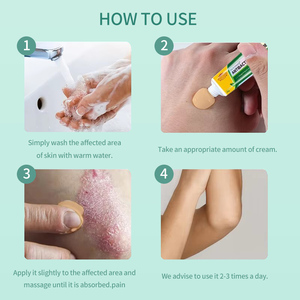 Krim kulit Herbal hijau kustom pabrik krim Dermatitis eksim antipruritik kulit - Product Image 5