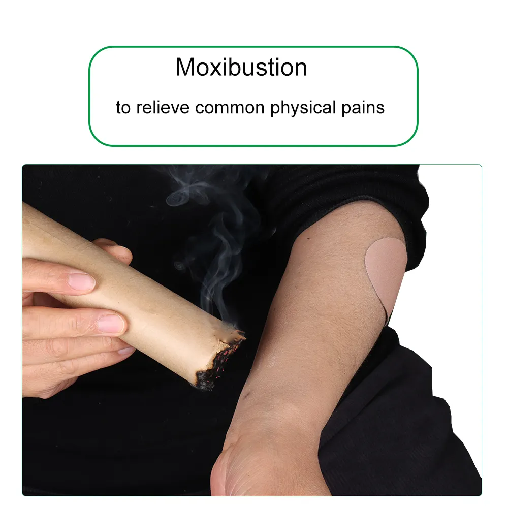 Moxibustion technique training TradItional Chinese Medicine physiotherapy training