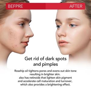 Aceite de rosa mosqueta Natural puro 100% de etiqueta privada, reduce la almeja de línea <span class=keywords><strong>fina</strong></span>, ilumina la piel, elimina las manchas oscuras, cicatriz, reduce los poros, aceite esencial - Product Image 2