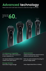 Periodmed Ultrasound Scanner Medical Handheld Handheld Portable Ultrasound Device Ultrasound <strong>Probe</strong> Wireless - Product Image 3