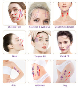 ไหม <span class=keywords><strong>PDO</strong></span> / PLLA / WPDO แบบใช้แล้วทิ้ง ปลายทู่ สำหรับยกกระชับใบหน้า เติมเต็มรูปหน้าด้วย PCL - Product Image 4