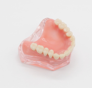 Anatomisch <span class=keywords><strong>mini</strong></span>-tandenmodel Tandenonderwijsmodel Tandheelkundig restauratiemodel met 4 implantaten Overkappingsprothese Inferieur onderwijsmodel - Product Image 5