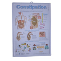 Affiche murale éducative en plastique 3D sur l'anatomie médicale de la grossesse et du processus de naissance