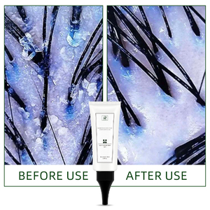 Crème Exfoliante Bio et Non Testée sur les Animaux pour le Cuir Chevelu, Purifiante en Profondeur, Soin Botanique Déboucheur de Pores, Soin Capillaire - Product Image 5